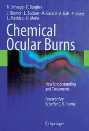 Chemical Ocular Burns