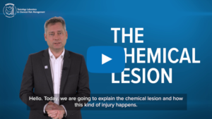 thumbnail chemical lesion